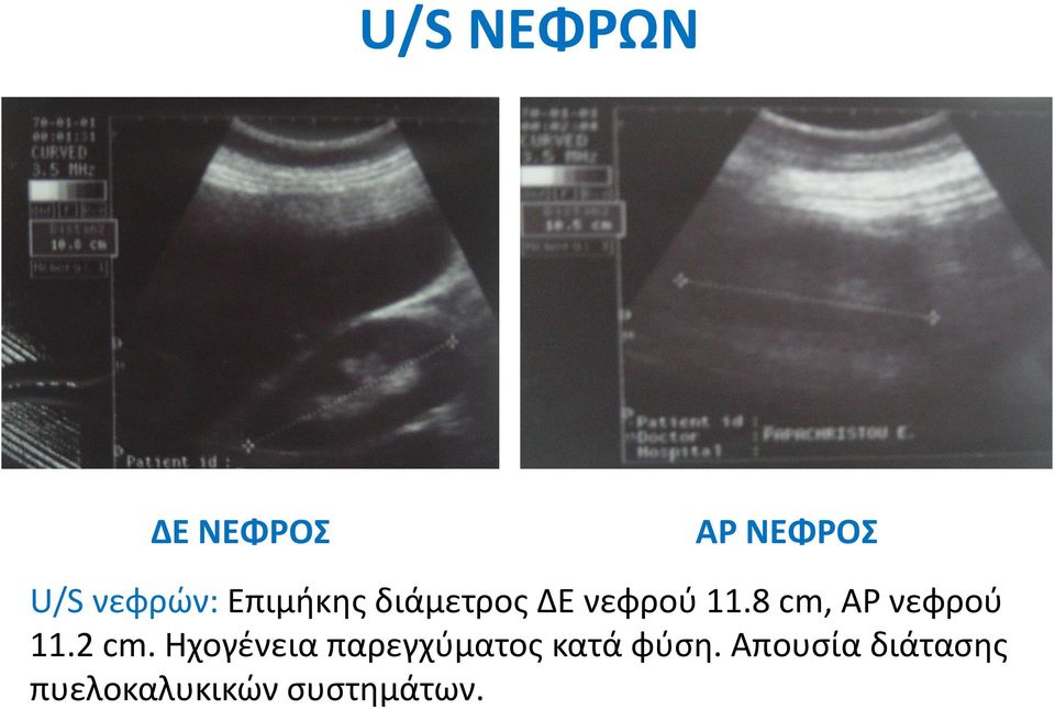 ιά 11.2 cm.