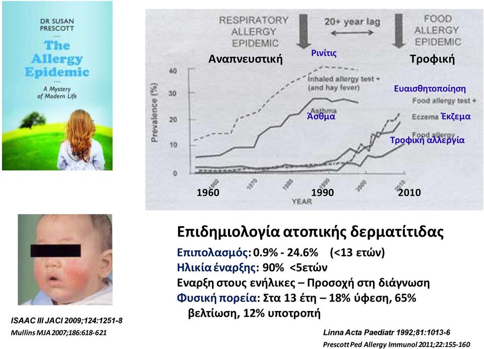 6% (<13 ετϊν) Ηλικία ζναρξθσ: 90% <5ετϊν Εναρξθ ςτουσ ενιλικεσ Προςοχι ςτθ διάγνωςθ Φυςικι πορεία: τα 13 ζτθ