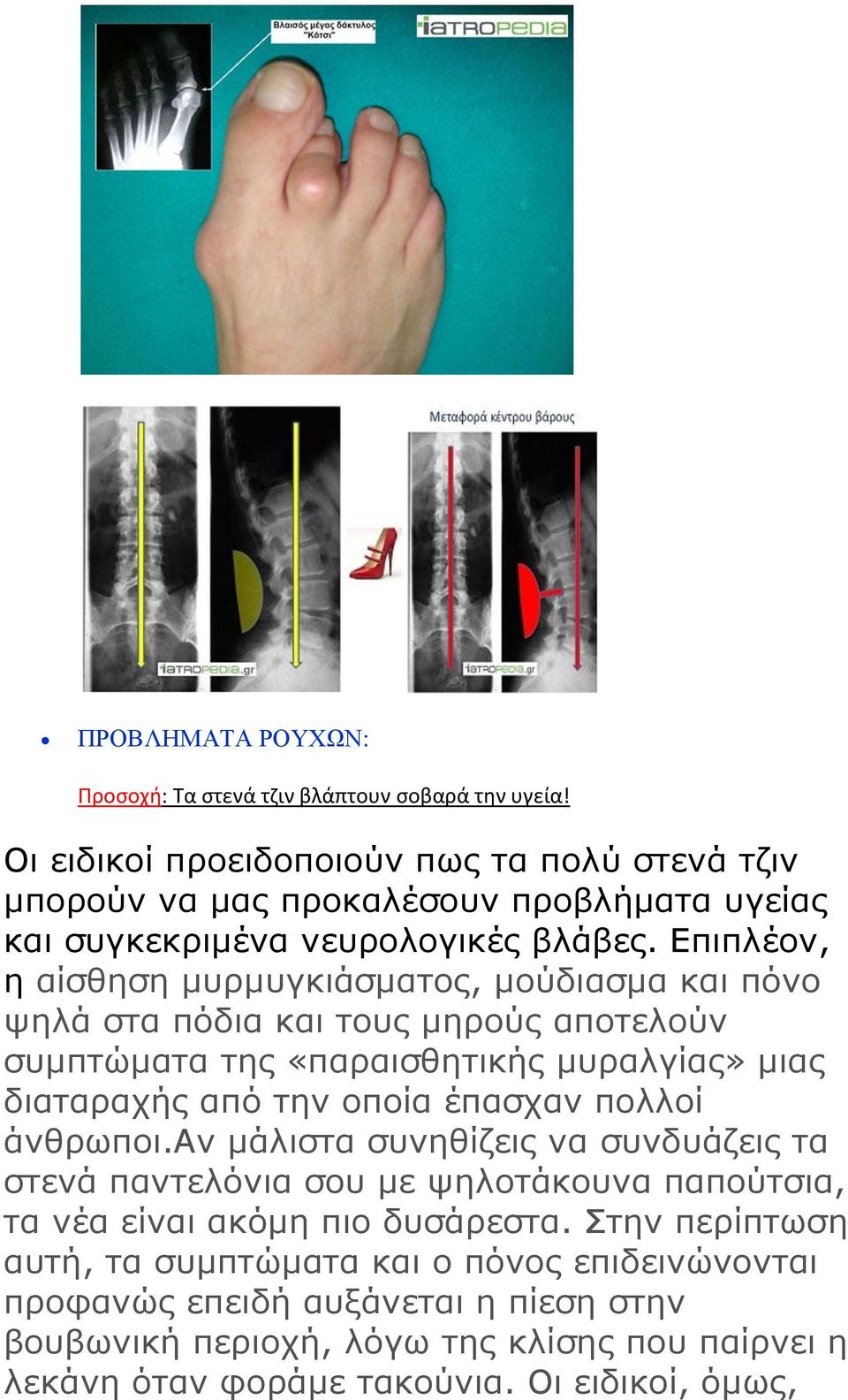 Επηπιένλ, ε αίζζεζε κπξκπγθηάζκαηνο, κνύδηαζκα θαη πόλν ςειά ζηα πόδηα θαη ηνπο κεξνύο απνηεινύλ ζπκπηώκαηα ηεο «παξαηζζεηηθήο κπξαιγίαο» κηαο δηαηαξαρήο από ηελ νπνία έπαζραλ