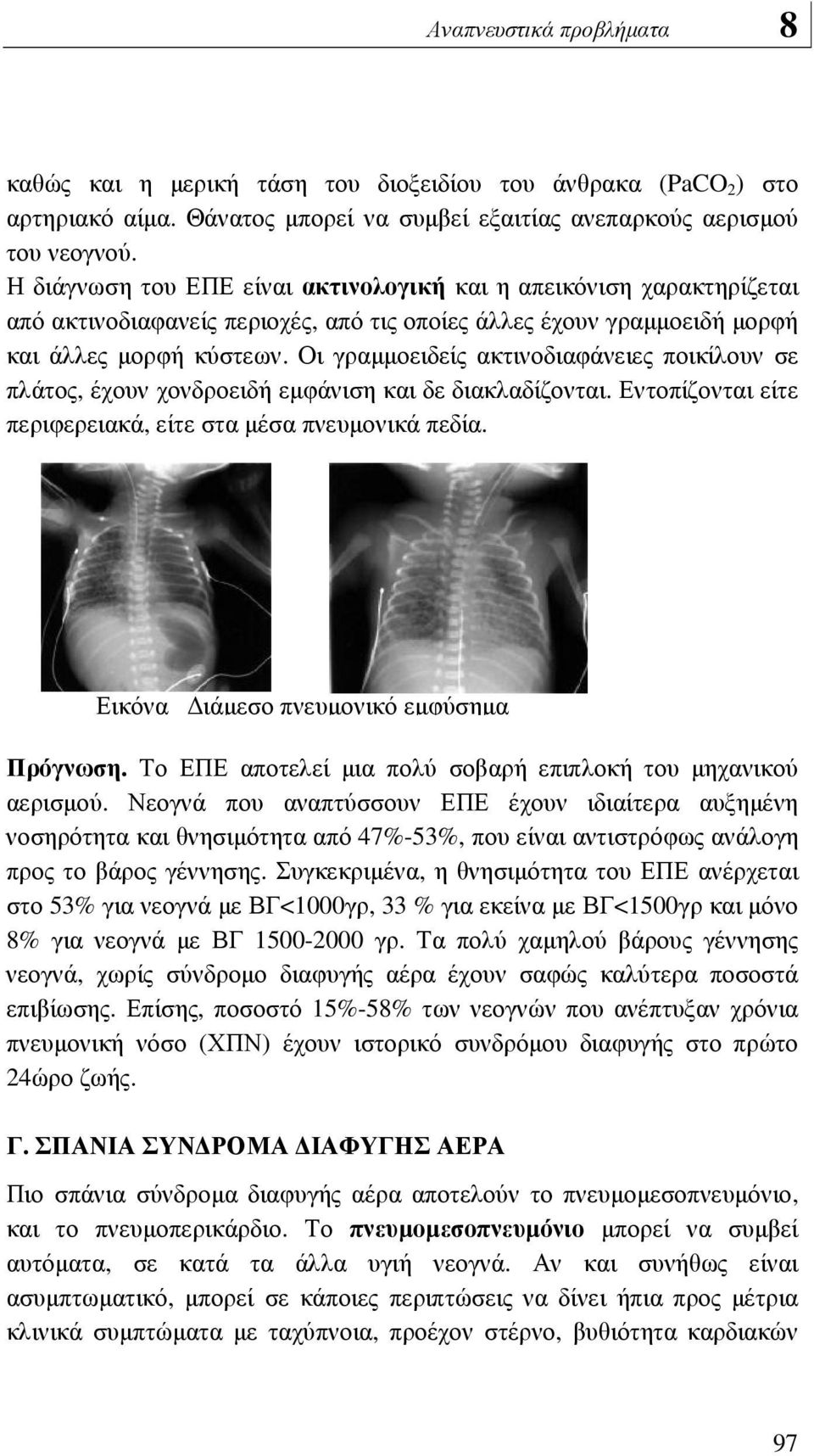 Οι γραµµοειδείς ακτινοδιαφάνειες ποικίλουν σε πλάτος, έχουν χονδροειδή εµφάνιση και δε διακλαδίζονται. Εντοπίζονται είτε περιφερειακά, είτε στα µέσα πνευµονικά πεδία.