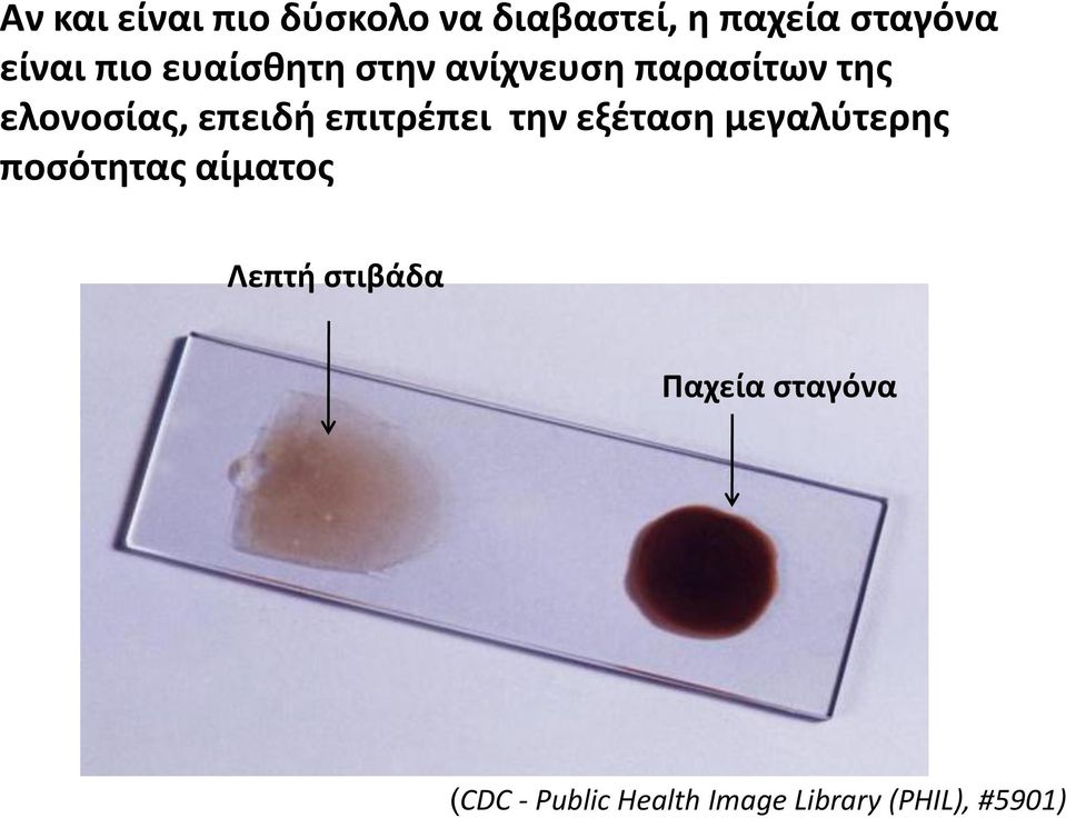 επιτρζπει τθν εξζταςθ μεγαλφτερθσ ποςότθτασ αίματοσ Λεπτι