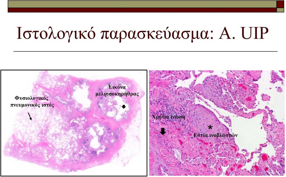 ιστός Εικόνα μελισσοκηρήθρας