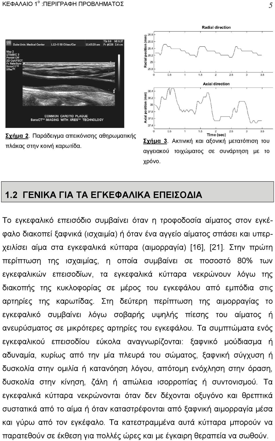 2 ΓΕΝΙΚΑ ΓΙΑ ΤΑ ΕΓΚΕΦΑΛΙΚΑ ΕΠΕΙΣΟ ΙΑ Το εγκεφαλικό επεισόδιο συµβαίνει όταν η τροφοδοσία αίµατος στον εγκέφαλο διακοπεί ξαφνικά (ισχαιµία) ή όταν ένα αγγείο αίµατος σπάσει και υπερχειλίσει αίµα στα