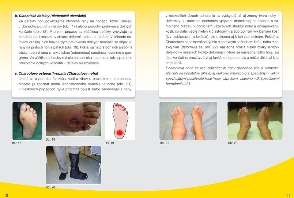 V prípade defektov vznikajúcich hlavne zlým prekrvením dolných končatín sa objavujú rany na prstoch nôh a pätách (obr. 19).
