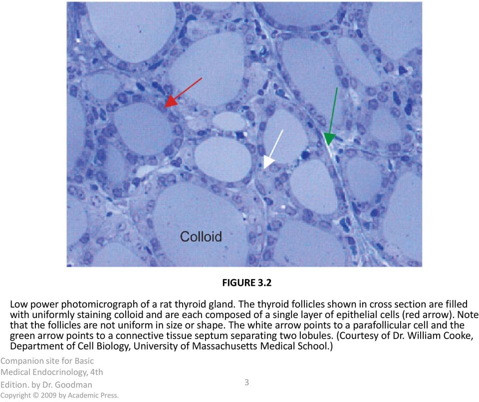 Note that the follicles are not uniform in size or shape.