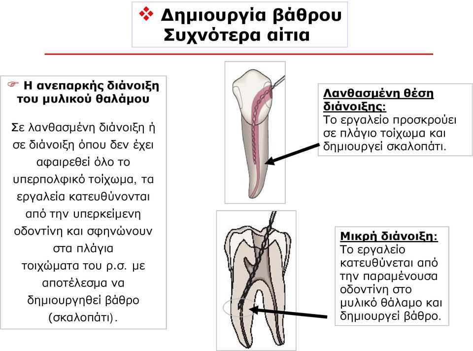 του ρ.σ. με αποτέλεσμα να δημιουργηθεί βάθρο (σκαλοπάτι).