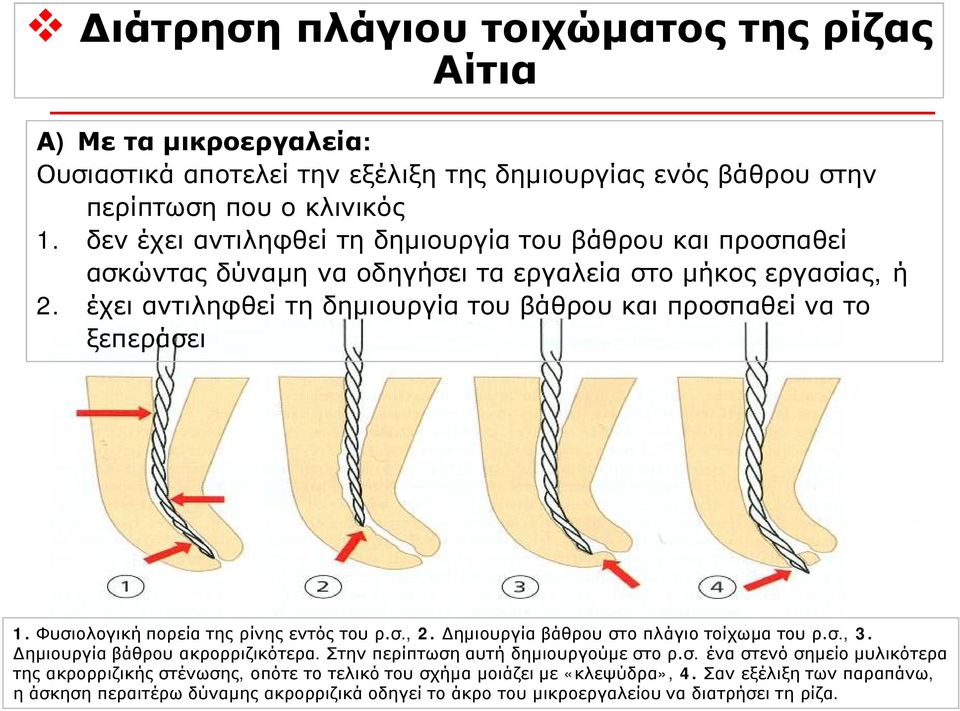 έχει αντιληφθεί τη δημιουργία του βάθρου και προσπαθεί να το ξεπεράσει 1. Φυσιολογική πορεία της ρίνης εντός του ρ.σ., 2. Δημιουργία βάθρου στο πλάγιο τοίχωμα του ρ.σ., 3.