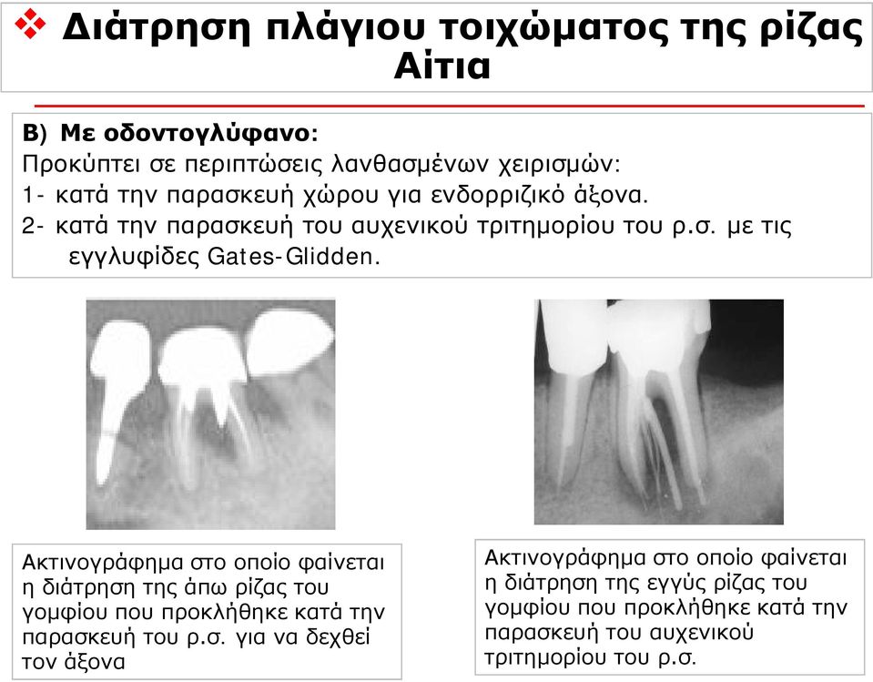 Ακτινογράφημα στ