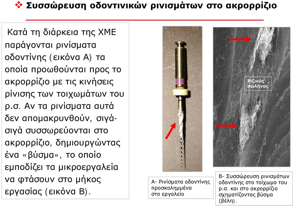 ις ρίνιση