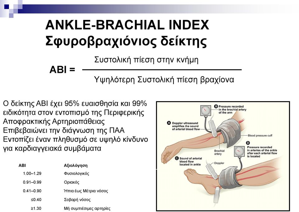 Δπηβεβαηώλεη ηελ δηάγλσζε ηεο ΠΑΑ Δληνπίδεη έλαλ πιεζπζκό ζε πςειό θίλδπλν γηα θαξδηαγγεηαθά ζπκβάκαηα ABI