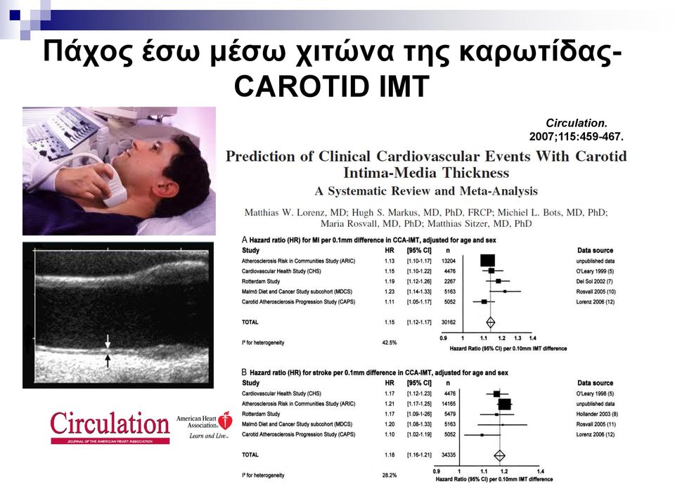 θαξσηίδαο- CAROTID