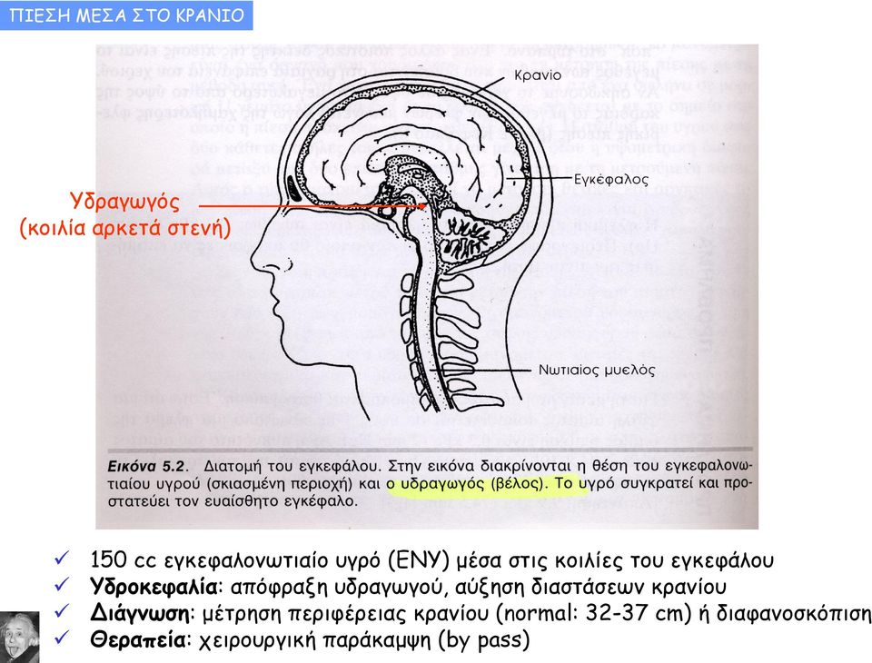 απόφραξη υδραγωγού, αύξηση διαστάσεων κρανίου Διάγνωση: μέτρηση