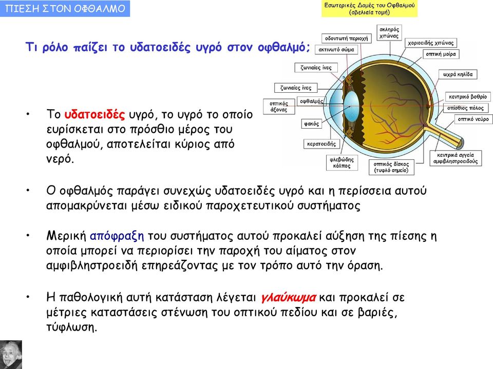 Ο οφθαλμός παράγει συνεχώς υδατοειδές υγρό και η περίσσεια αυτού απομακρύνεται μέσω ειδικού παροχετευτικού συστήματος Μερική απόφραξη του συστήματος