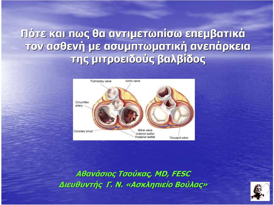 της µιτροειδούς βαλβίδος Αθανάσιος