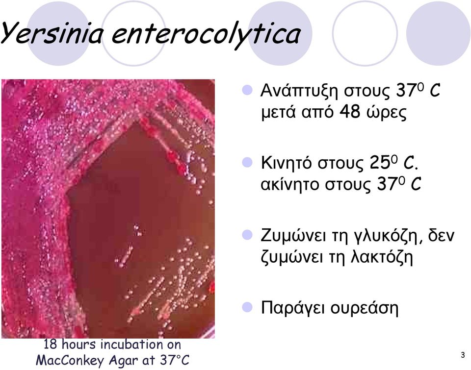 ακίνητοστους 37 0 C Ζυµώνει τη γλυκόζη, δεν ζυµώνει