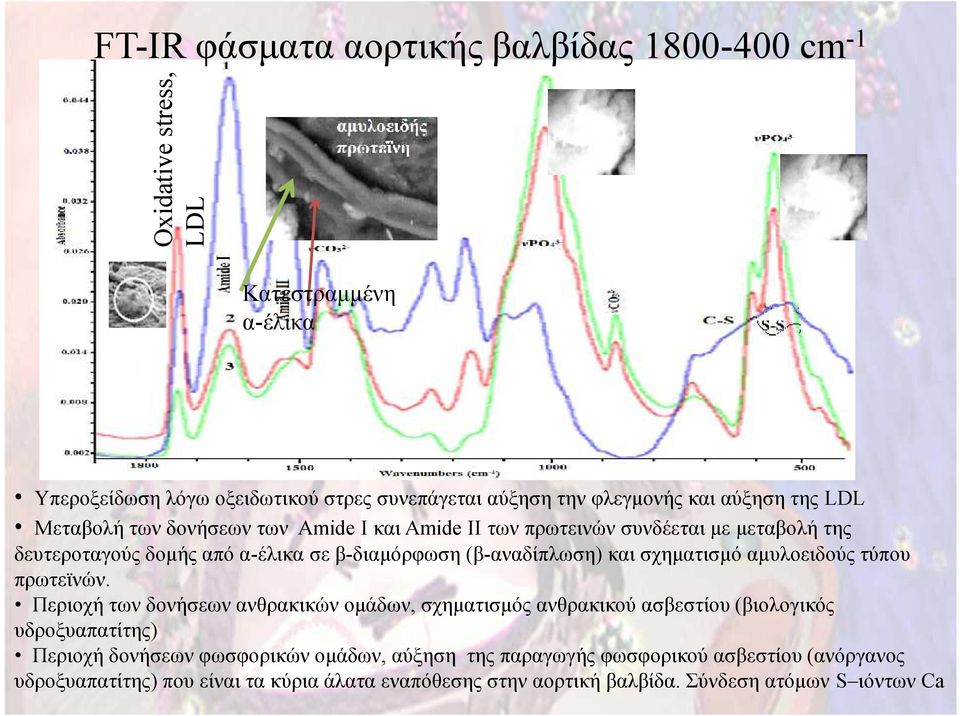 και σχηματισμό αμυλοειδούς τύπου πρωτεϊνών.