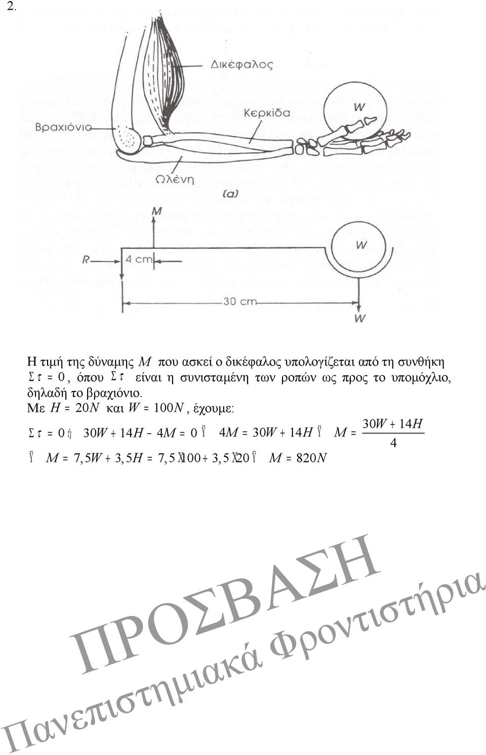 βραχιόνιο.