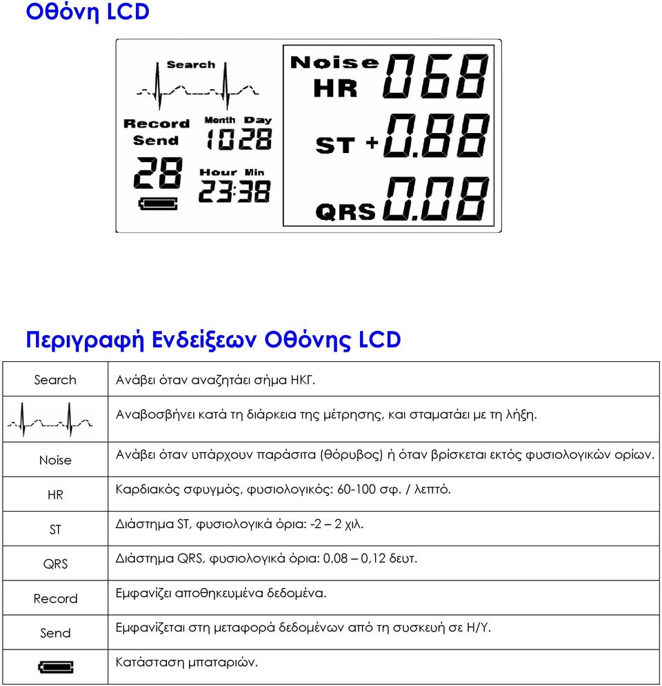 Noise HR ST QRS Record Send Ανάβει όταν υπάρχουν παράσιτα (θόρυβος) ή όταν βρίσκεται εκτός φυσιολογικών ορίων.