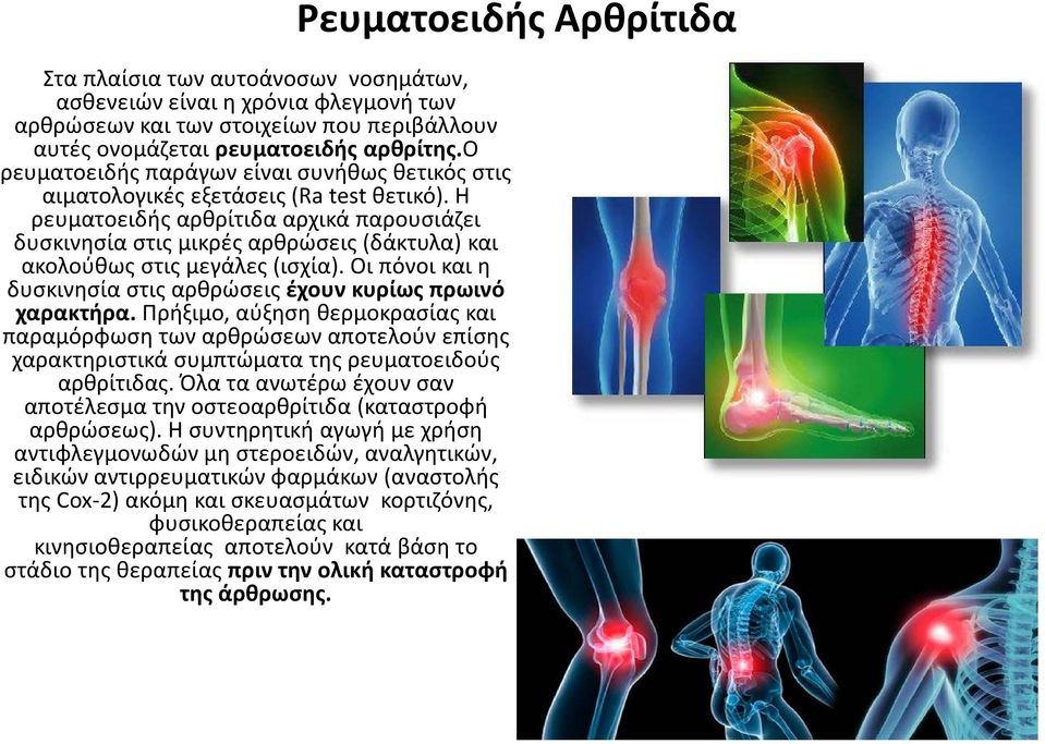 Η ρευματοειδής αρθρίτιδα αρχικά παρουσιάζει δυσκινησία στις μικρές αρθρώσεις (δάκτυλα) και ακολούθως στις μεγάλες (ισχία). Οι πόνοι και η δυσκινησία στις αρθρώσεις έχουν κυρίως πρωινό χαρακτήρα.