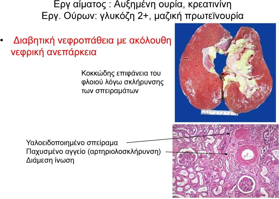 αθόινπζε λεθξηθή αλεπάξθεηα Κνθθώδεο επηθάλεηα ηνπ θινηνύ ιόγσ