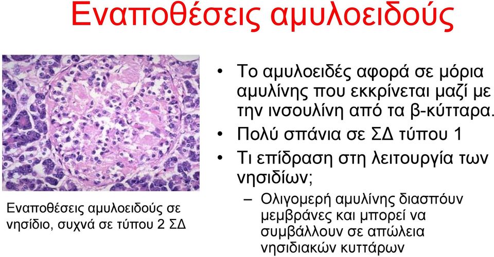 β-θύηηαξα.