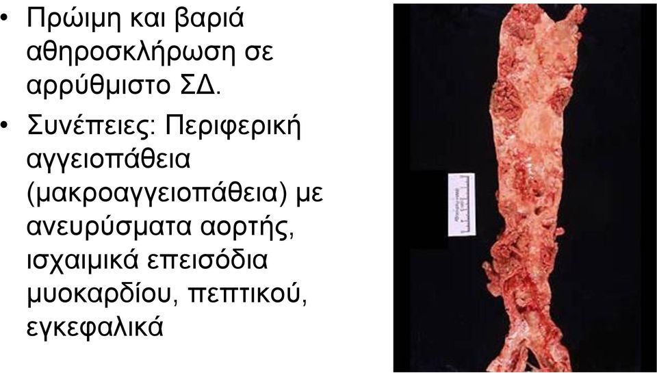 (καθξναγγεηνπάζεηα) κε αλεπξύζκαηα ανξηήο,