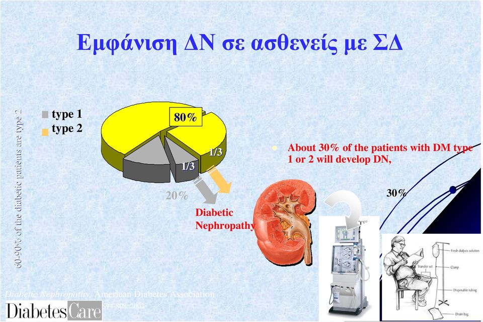 the patients with DM type 1 or 2 will develop DN, 30% Diabetic