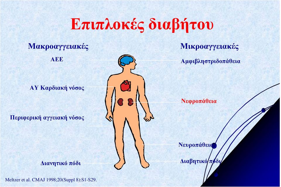 Περιφερική αγγειακή νόσος Νευροπάθεια ιανητικό πόδι