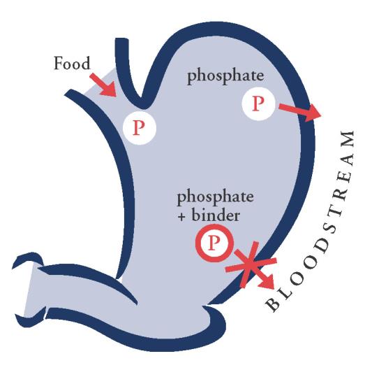 Oral phosphate binders Oral phosphate binders work by forming insoluble complexes in the gut and