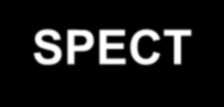 G-SPECT