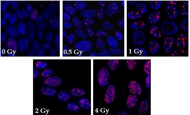 Εικόνα 5.2 Καρκινικά κύτταρα MCF-7 εκτεθειμένα σε διάφορες δόσεις ιοντίζουσας ακτινοβολίας.