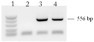 Θέση 1: δείκτης μοριακών βαρών 50-766bp Θέση 2: τυφλό Θέσεις 3 και 4: δείγματα Σχήμα 5.10: Αντιπροσωπευτική PCR για το εξόνιο 4α (1,5 %w/v, gel αγαρόζης).