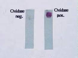 Δοκιμασία οξειδάσης Ελέγχει αν ο μικροοργανισμός διαθέτει το ένζυμο cytochrome oxidase, απαραίτητο στην μετατροπή NADH NAD + H 2 O Χρησιμοποιούμε