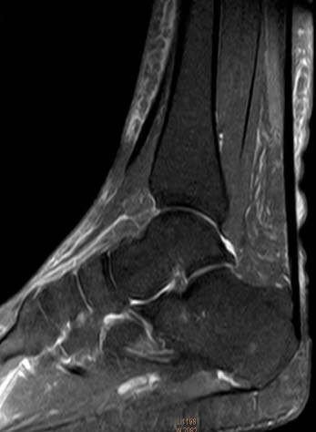 ΦΥΣΙΟΛΟΓΙΚΗ ΑΠΕΙΚΟΝΙΣΗ ΜΕ MRI