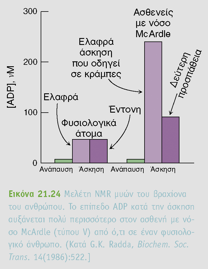 Νόσος του McArdle (τύπου V) περιορισμένη ικανότητα εκτέλεσης άσκησης, επώδυνοι μυϊκοί πόνοι.