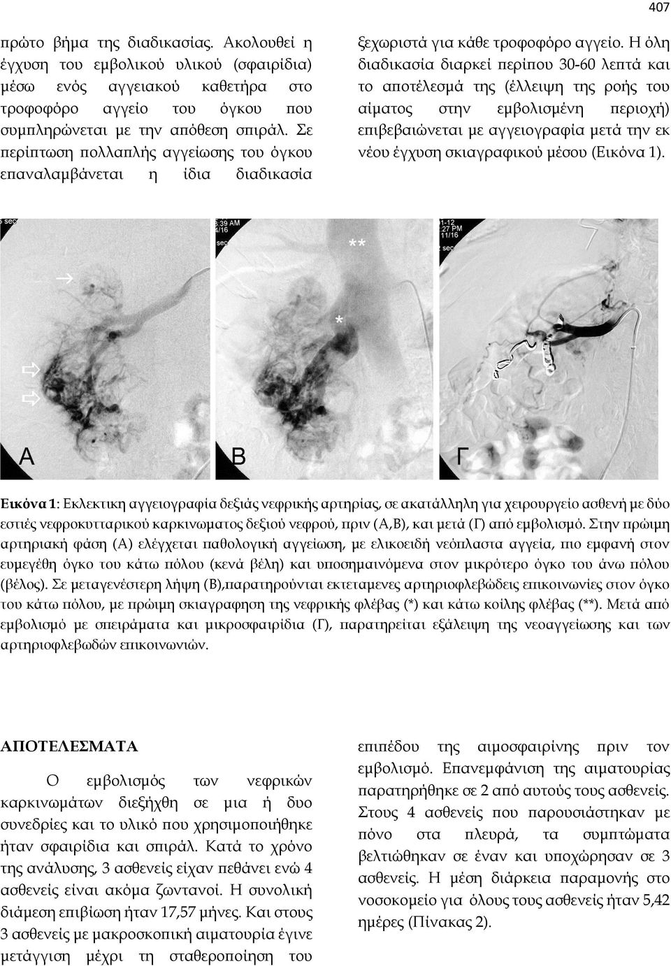 Η όλη διαδικασία διαρκεί περίπου 30-60 λεπτά και το αποτέλεσμά της (έλλειψη της ροής του αίματος στην εμβολισμένη περιοχή) επιβεβαιώνεται με αγγειογραφία μετά την εκ νέου έγχυση σκιαγραφικού μέσου