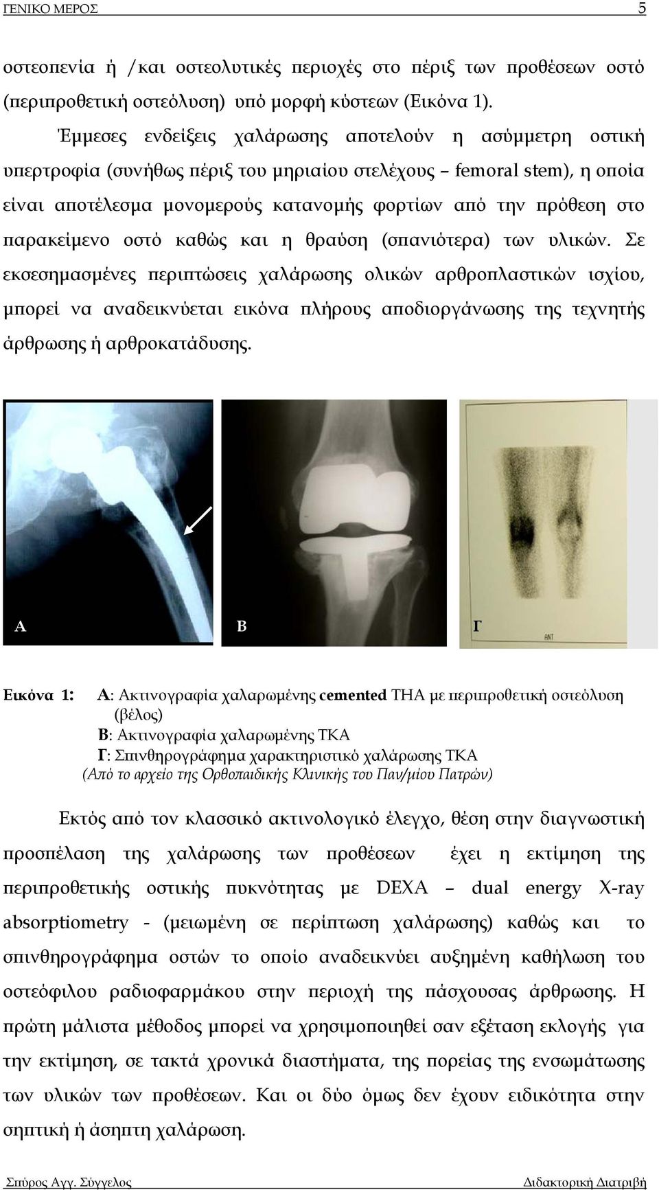 παρακείµενο οστό καθώς και η θραύση (σπανιότερα) των υλικών.