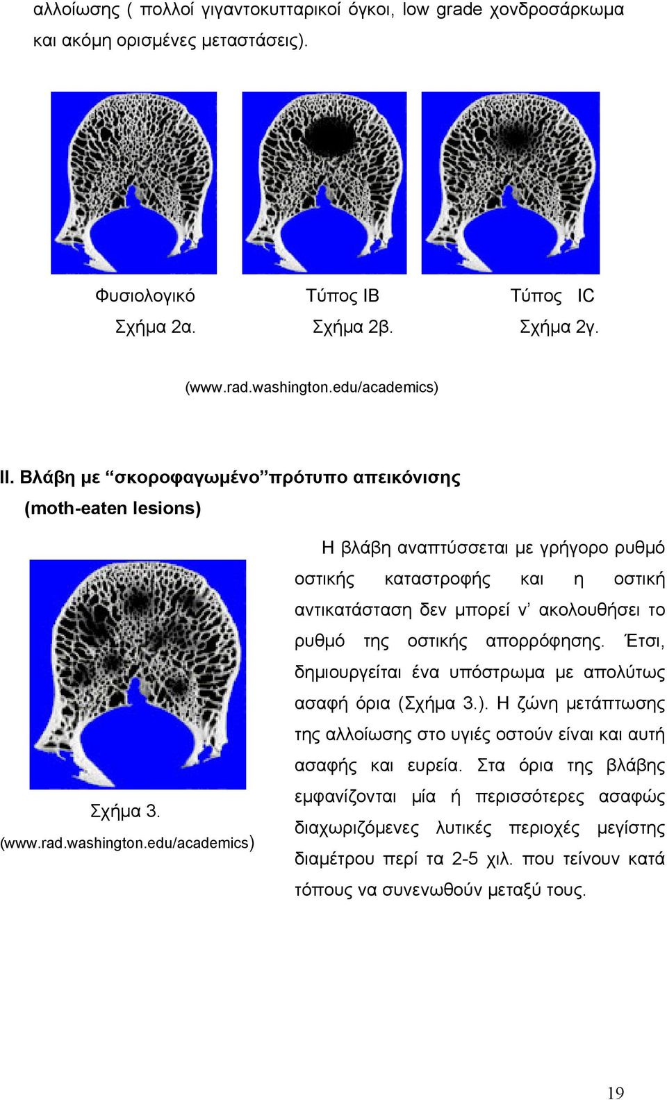 edu/academics) Η βλάβη αναπτύσσεται με γρήγορο ρυθμό οστικής καταστροφής και η οστική αντικατάσταση δεν μπορεί ν ακολουθήσει το ρυθμό της οστικής απορρόφησης.