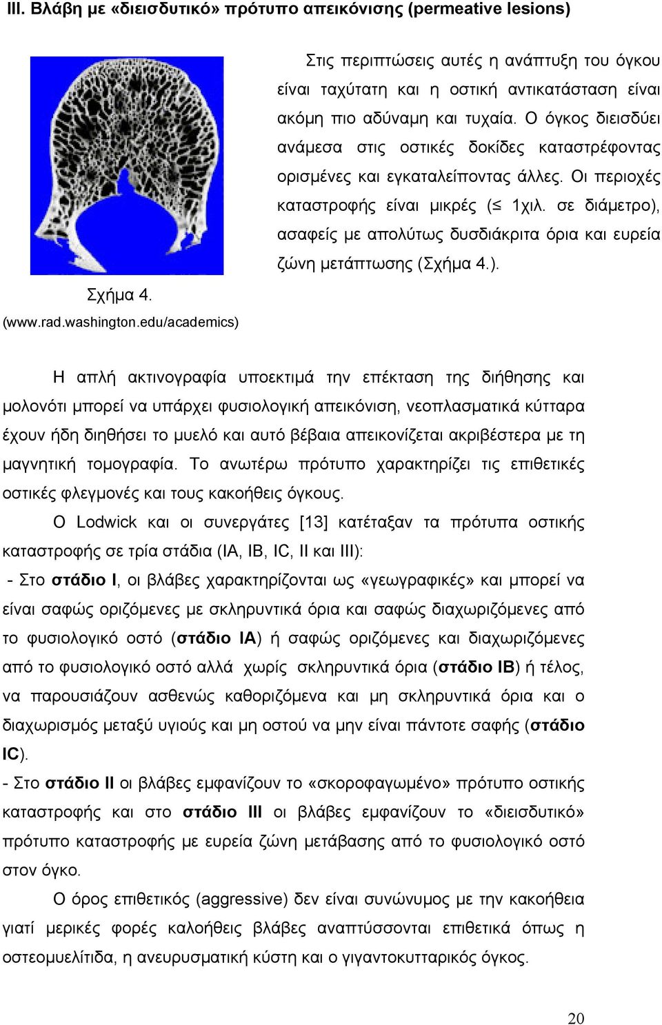 Ο όγκος διεισδύει ανάμεσα στις οστικές δοκίδες καταστρέφοντας ορισμένες και εγκαταλείποντας άλλες. Οι περιοχές καταστροφής είναι μικρές ( 1χιλ.