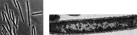 Taq DNA polymerase: Thermus