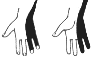 συνέχεια πίνακα VΙ Νεύρο Προσβαλλόμενοι μύες Λειτουργία Αισθητική περιοχή Ωλένιο νεύρο Α 8 -Θ 1 Βραχύς καμπτήρας μικρού δακτύλου Ελμινθοειδείς ΙΙΙ-ΙV Μεσόστεοι Προσαγωγός του αντίχειρα Βραχύς