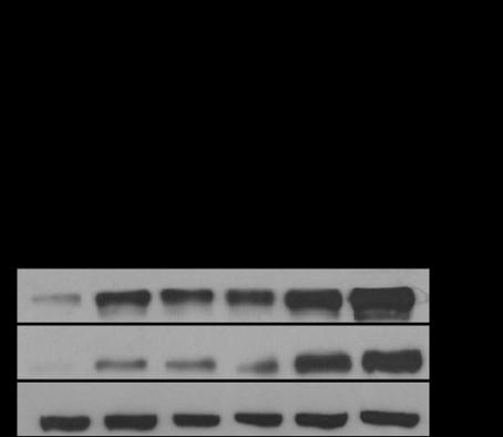 Α. Β. Σχήμα 37. Α. Επαγωγή της p53 και της p21 από το DOX και από το Nutlin -3a όπως ανιχνεύτηκε μέσω ανοσοαποτύπωσης κατά Western σε ιστούς από πάγκρεας μυών αγρίου τύπου. Β. Η ποσοτικοποίηση των αποτελεσμάτων αυτών έγινε μέσω επιπέδων της ακτίνης.