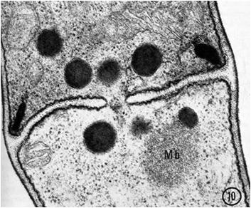 Ποικιλότητα Υ Γλυοξυσώματα Φυτά και filamentous fungi περιέχουν ένζυμα β-oxidation, σύνθεσης και αποικοδόμησης H2O2 αλλά και σημαντικά ένζυμα του ΓΛΥΟΞΥΛΙΚΟΥ ΚΥΚΛΟΥ (λίπη σε σάκχαρα) Woronin bodies