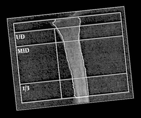 Simon J et al. JBMR 2011;26 (Suppl.