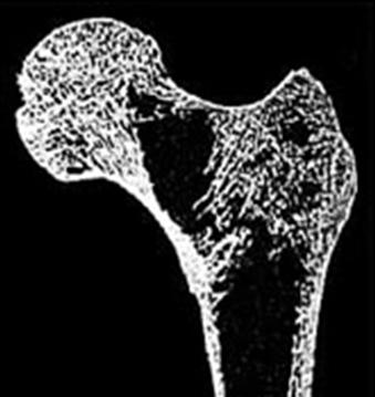 Μέγιστη φόρτιση[n] Femur neck peak load (N) Dmab : αντοχής σπογγώδους και φλοιώδους σε ωοθηκεκτομηθείσες μαϊμούδες 4 Μέγιστη φόρτιση L3-L4 σπονδυλικών σωμάτων ^ ^ 2