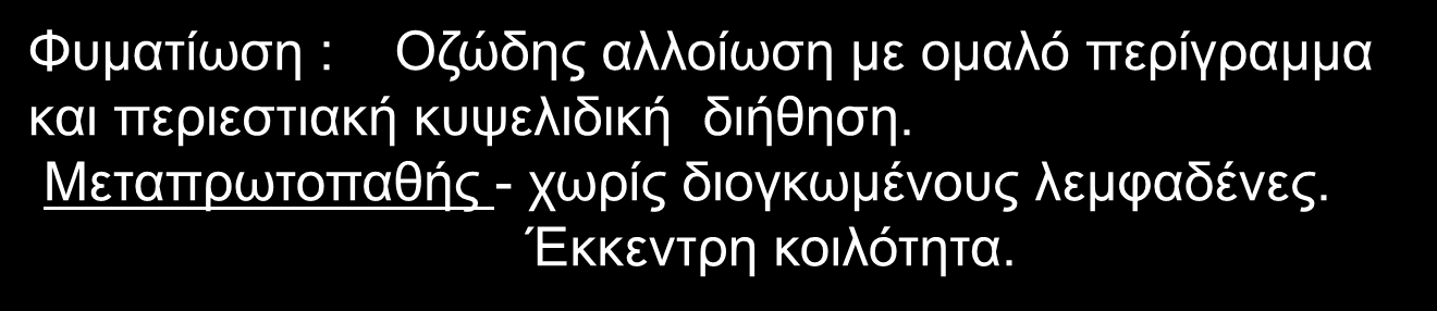 διήθηση. Μεταπρωτοπαθής - χωρίς διογκωμένους λεμφαδένες.