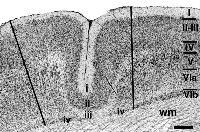 run from the surface to the white matter. (Adapted from Kaas et al. 1981.) B. Detail of the columnar organization of inputs from digits 2, 3, 4, and 5 in a portion of Brodmann's area 3b.