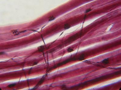 Νευρομυϊκή σύναψη Τελική κινητική πλάκα: o επιφάνεια της κυτταροπλασματικής μεμβράνης της μυϊκής ίνας που βρίσκεται κάτω από