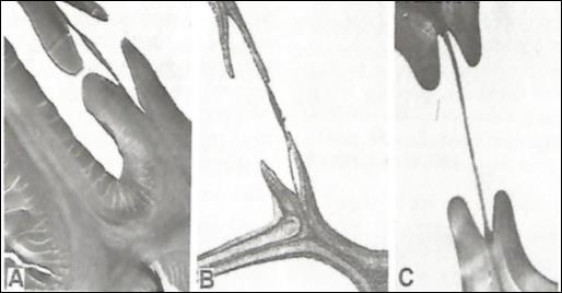 Εικόνα 4.1 Μακροσκοπική εμφάνιση θλιψιγενούς ξύλου σε εγκάρσια τομή ξύλου τσούγκας (Α), ερυθρελάτης (Β) (Hoadley, 1990) και πεύκης (Γ) (Panshin & De Zeeuw, 1980).
