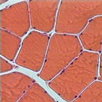 ΑΠΑΝΤΗΣΗ Οι μυϊκές ίνες έχουν εκατοντάδες έως και χιλιάδες από αυτά στην περιφέρειά τους (έξω από την κυτταρική